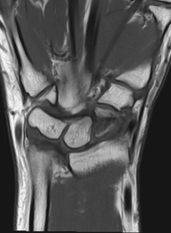 Patient having physio treatment on their foot